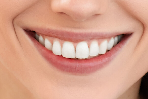 zähne photoshop aktionen